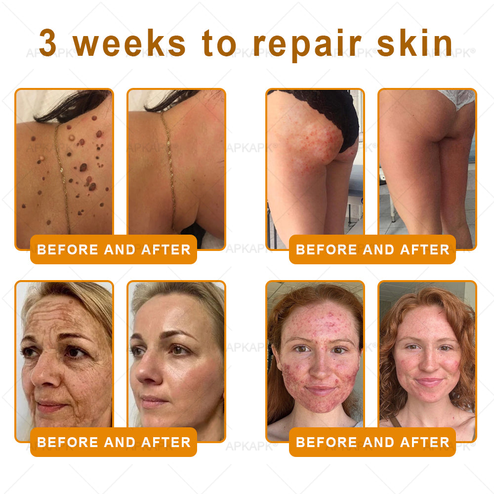 𝐌𝐇𝐑𝐀 𝖮𝖿𝖿𝗂𝖼𝗂𝖺𝗅 𝖲𝗍𝗈𝗋𝖾 👨⚕️ Made and Shipped from UK ✨✨ APKAPK® Bee venom Comprehensive Cream 🔥 LAST DAY 80% OFF 💎💎💎