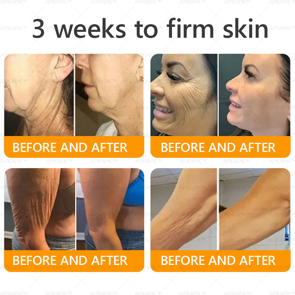 𝐌𝐇𝐑𝐀 𝖮𝖿𝖿𝗂𝖼𝗂𝖺𝗅 𝖲𝗍𝗈𝗋𝖾 👨⚕️ Made and Shipped from UK ✨✨ APKAPK® Bee venom Comprehensive Cream 🔥 LAST DAY 80% OFF 💎💎💎