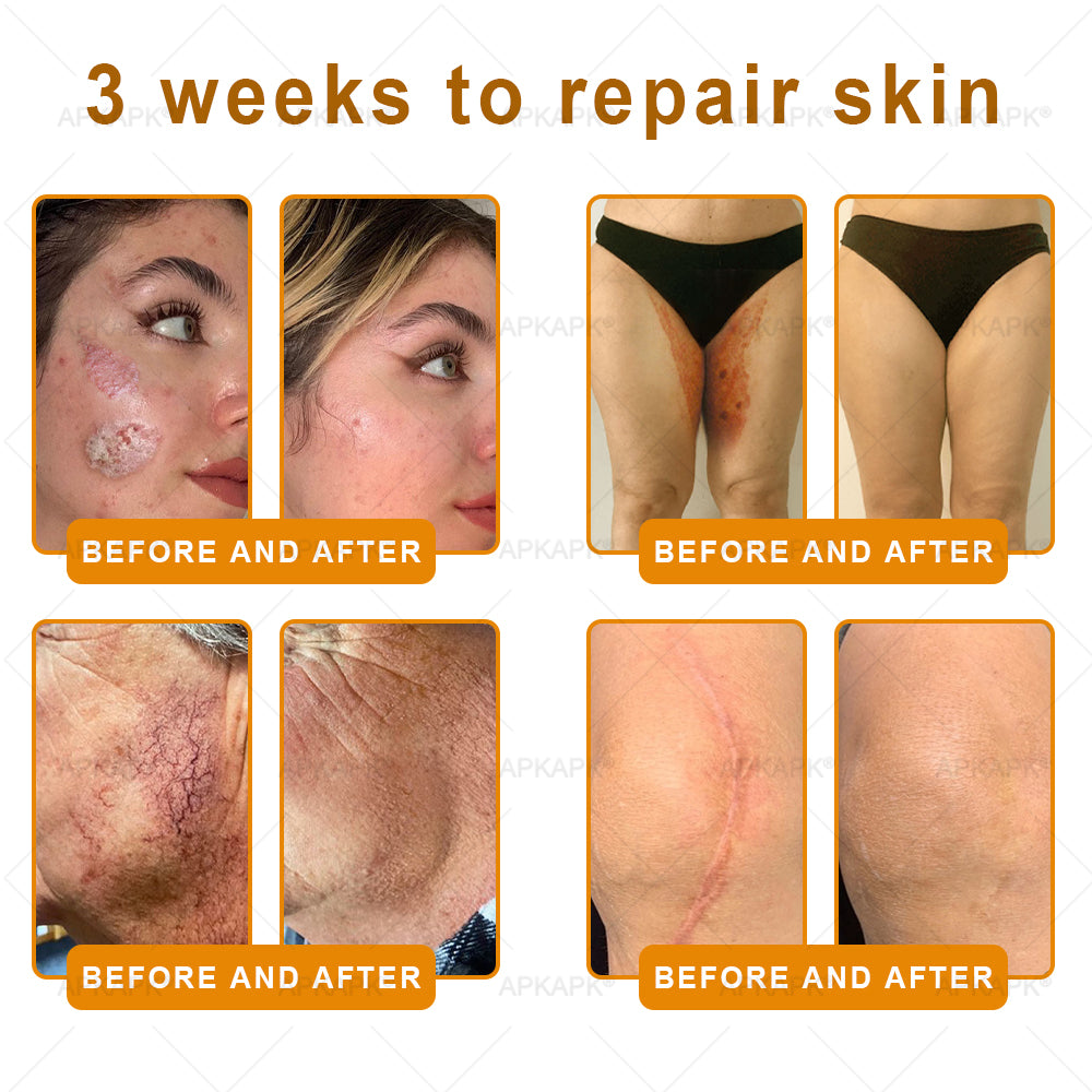 𝐌𝐇𝐑𝐀 𝖮𝖿𝖿𝗂𝖼𝗂𝖺𝗅 𝖲𝗍𝗈𝗋𝖾 👨⚕️ Made and Shipped from UK ✨✨ APKAPK® Bee venom Comprehensive Cream 🔥 LAST DAY 80% OFF 💎💎💎