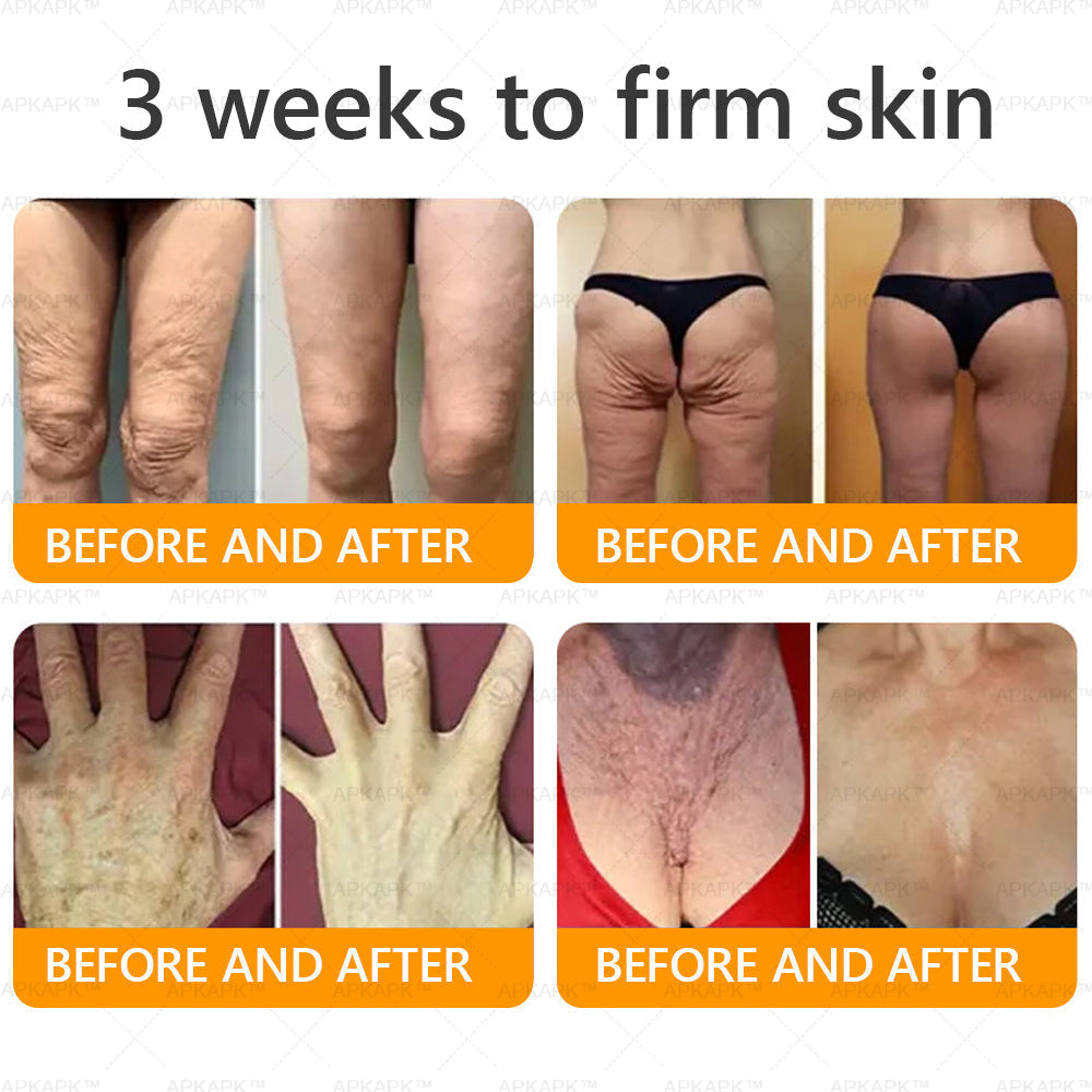 𝐌𝐇𝐑𝐀 𝖮𝖿𝖿𝗂𝖼𝗂𝖺𝗅 𝖲𝗍𝗈𝗋𝖾 👨⚕️ Made and Shipped from UK ✨✨ APKAPK® Bee venom Comprehensive Cream 🔥 LAST DAY 80% OFF 💎💎💎